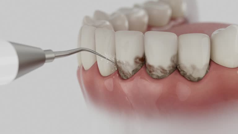 Reliable Dental contractor in Michigan City, IN by Dentist Open Now